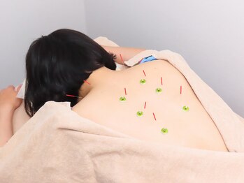 グッバイ鍼灸院整骨院整体院(good bye鍼灸院整骨院整体院)/鍼灸