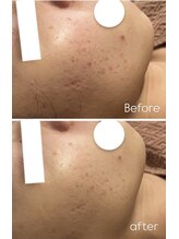 リノ(LINO)/次の日メイクが楽しく♪