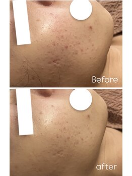 リノ(LINO)/次の日メイクが楽しく♪