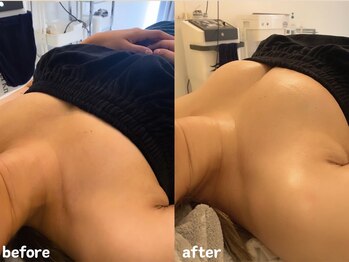 エムプリュ 心斎橋店(M.plus)/本当は顔もおみせしたい！