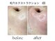 ヘラ(HERA)の写真