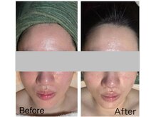 ミイン(MIIN)/ララピール＆水玉リフティング