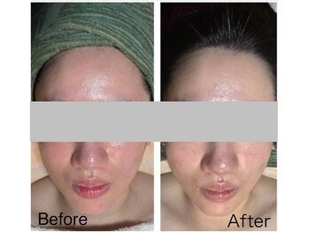 ミイン(MIIN)/ララピール&水玉リフティング