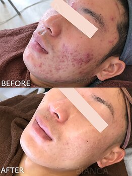 ビアンカ/お客様のお声