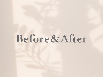 リコス(LICCO’S)/施術のbefore&after公開♪