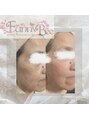 ファニービー 吹田店&nbsp;シミがなかったことに！シワやクマも別人！