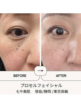 七や美肌の写真/《スピーディーな結果に満足度◎》シミ・しわ・たるみを改善。ナチュラルで若々しい印象にお仕上げします♪