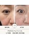 七や美肌の写真/《スピーディーな結果に満足度◎》シミ・しわ・たるみを改善。ナチュラルで若々しい印象にお仕上げします♪