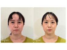スタイルキューピット(style cupit)/メイクビフォアフター＊30代