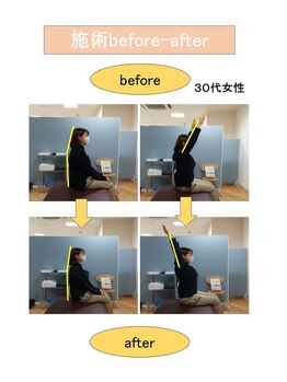 いみすぽ整体/30代女性ビフォアアフター