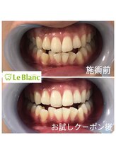 ルブラン 奈良店(Le Blanc)/大事なパートナー！！