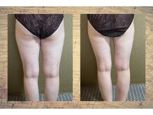 ルナルナ(RUNA RUNA)/ビフォー、アフター