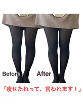 アサバ整体院 八潮店(ASABA整体院)/骨盤矯正でO脚矯正★結果写真