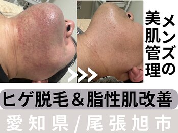 サロン イナンナ(Salon INANNA)/メンズのヒゲ脱毛♪