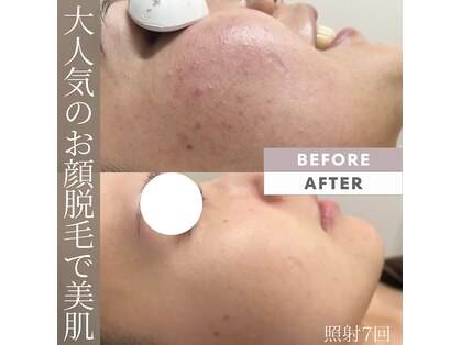 モアトゥインクル 山口店(MORE twinkle)の写真