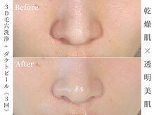 ゼアー(THERE FY.)/