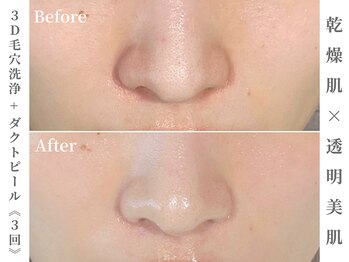 ゼアー(THERE FY.)/