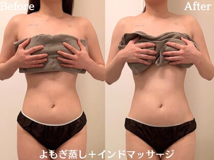 ルポナ(Reposna)の写真