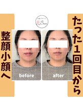 美顔デザインsuu.～若見えと歪み矯正専門の小顔サロン～/Before-After【30代】1回