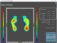 北千住の足【インソール×シューズ×足形】/計測結果（立位）