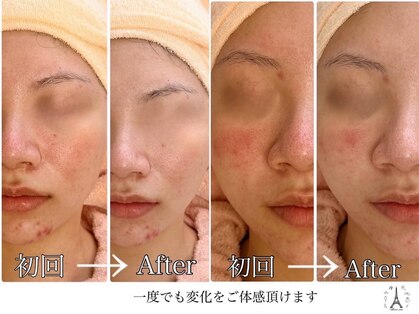 メルシーピコ(Merci pico)の写真
