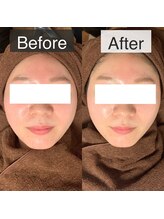 ベルフィーヌ 恵比寿店(BELFINE)/丸顔が気になる方必見！