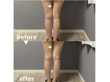 メゾン ド クロエ(Maison de Chloe)/CHLOE式パーソナル痩身