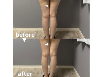 メゾン ド クロエ(Maison de Chloe)/CHLOE式パーソナル痩身