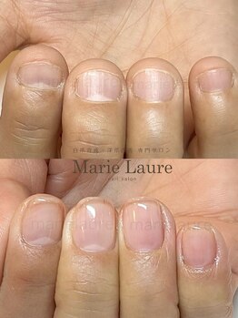 マリーロール 梅田店(Marie Laure)/深爪改善/自爪育成/ネイルケア