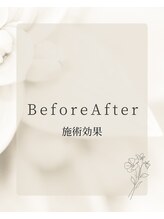 バンブー B2 新涯店(Bamboo)/お客様のBeforeAfter