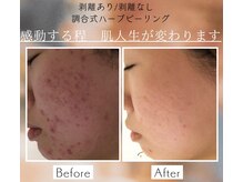 スノースキン(Snow skin)