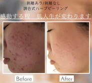 スノースキン(Snow skin)