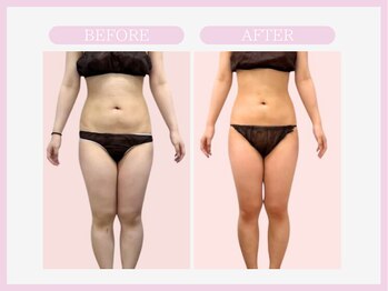 スリムライン 盛岡店(The Slim Line)/before→after