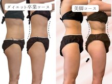 ヨサパーク ニコナ 三軒茶屋南口(YOSA PARK nicona)/短期間で集中ダイエット！