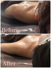 命の洗濯/筋膜を緩め,肩こり/頭痛を解消◎