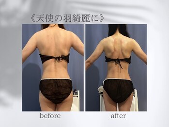 ジュプン 長崎/ブライダルエステ