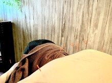 ハリーボ 銀座新富町(Hari-Bo)の雰囲気(お辛いところをお聞かせください。鍼灸/美容鍼/肩こり/腰痛)