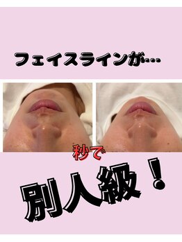 ミライ(Mirai)/たったの1時間で小顔へ