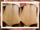ルーム207 新宿(ROOM207)の写真/【背中ニキビケア★ハーブピーリング80分¥8900】ブライダルやイベント前に最適★その場で効果実感!!