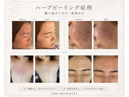 ベル 駒沢大学駅前(Belle)の写真
