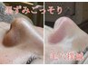【ドロドロ毛穴徹底除去】ハイドロ毛穴洗浄×毛穴エクストラクション¥16,500