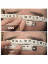 クレファ(CREFA)/美顔ヘッドスパ症例