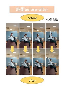 いみすぽ整体/40代女性ビフォアアフター