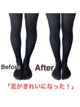 アサバ整体院 八潮店(ASABA整体院)/骨盤矯正でO脚改善★結果写真