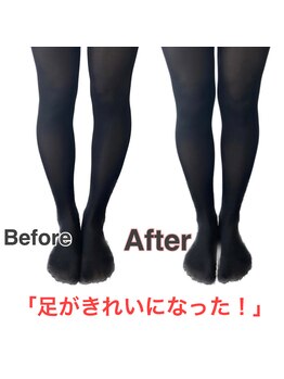 アサバ整体院 八潮店(ASABA整体院)/骨盤矯正でO脚改善★結果写真