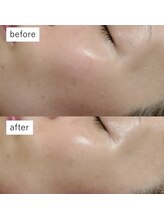 マリエンドリー/乾燥改善