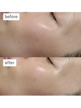 マリエンドリー/乾燥改善