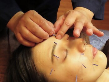 推拿處はりきゅあ はりきゅあ子宝院の写真/オーダーメイドの美容鍼施術で心身ともに美しい身体へ♪くま/ニキビ/ホウレイ線などでお悩みの方に!!