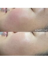 エメリーヌ(AIMELINE)/クリスティーナ　ビオフィート