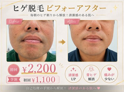 ルーム 上熊本(Lume)の写真